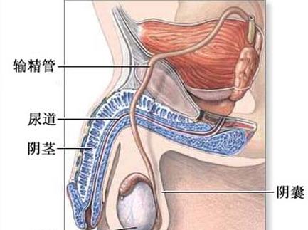 哪些原因会导致男性性功能障碍？
