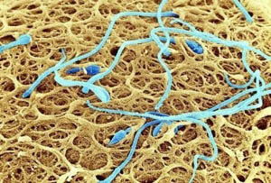 男性为什么会逆行射精?