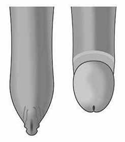 资阳做包皮手术要多少钱?