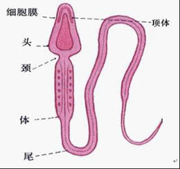引发男性出现死精症的原因有哪些?