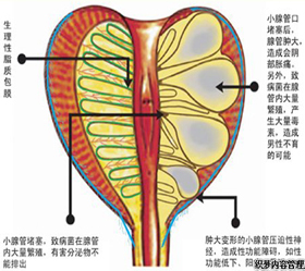 前列腺痛会给男性带来哪些影响呢?