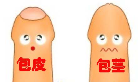 做完包茎手术后包皮水肿是怎么回事?