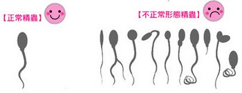 导致男性精子畸形的因素有什么呢